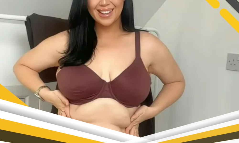 I tried every clothing trick & diet to shrink my belly & asked surgeons but nothing works – I now think it’s beautiful