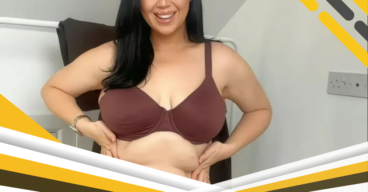 I tried every clothing trick & diet to shrink my belly & asked surgeons but nothing works – I now think it’s beautiful